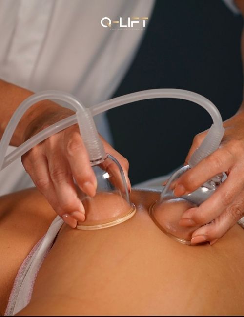 copppettazione gallery (1)