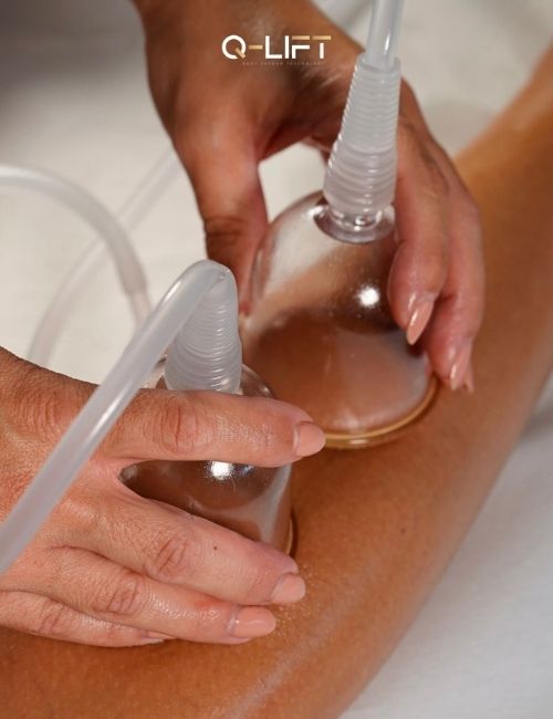 copppettazione gallery (2)