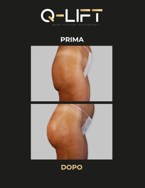 copppettazione gallery (3)