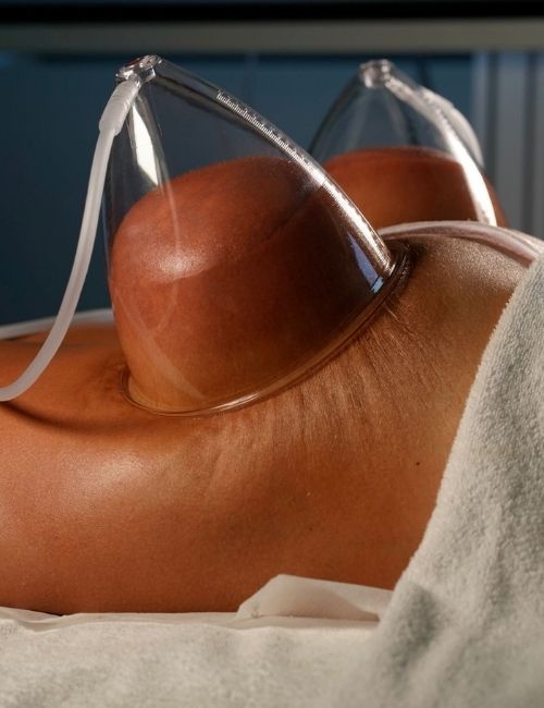 copppettazione gallery (4)